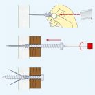 Gipszkarton tipli 43x10mm fém szárnyas (3045138)